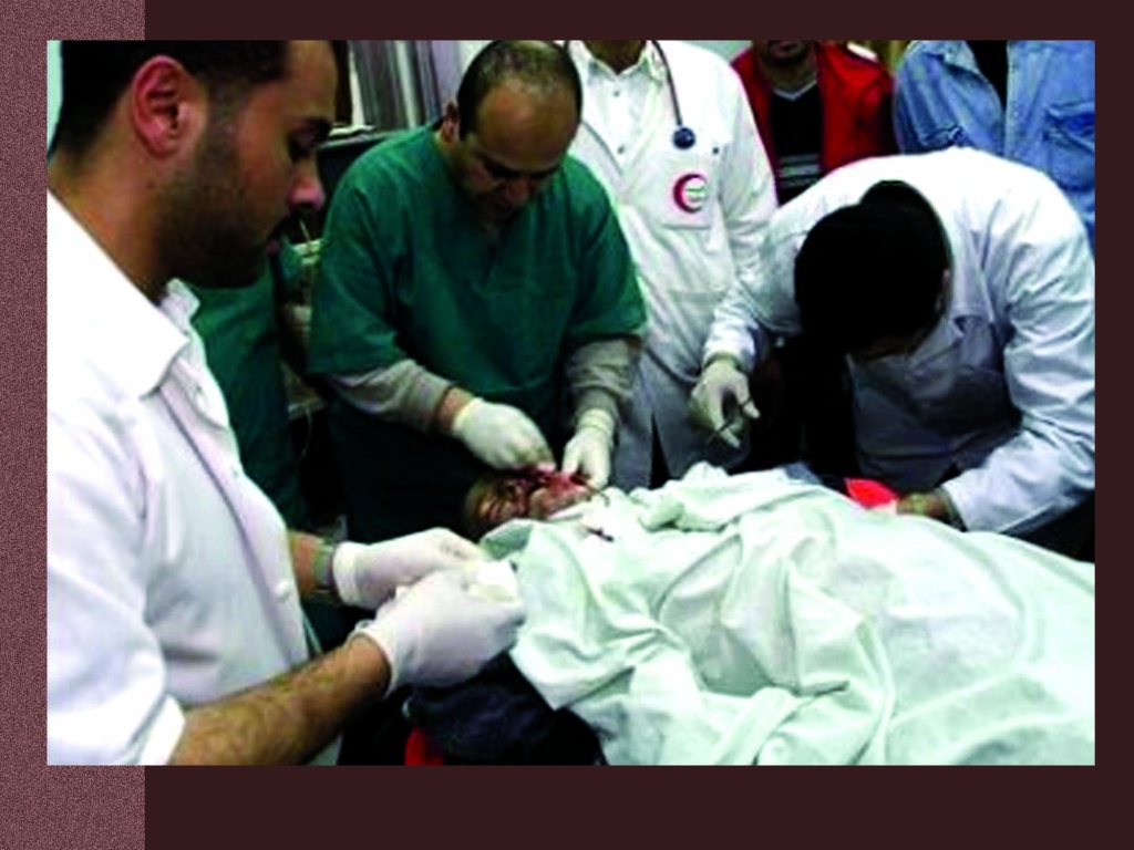 Drs at Hospital trying to save Rachel Corrie